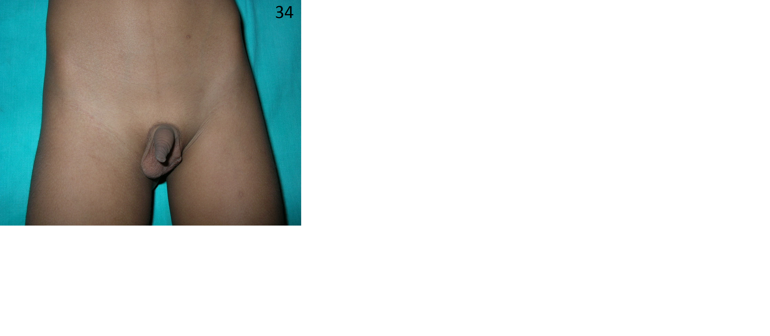 Pediatric General Surgery Image 6